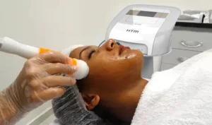 Radiofrequência facial: benefícios e indicações