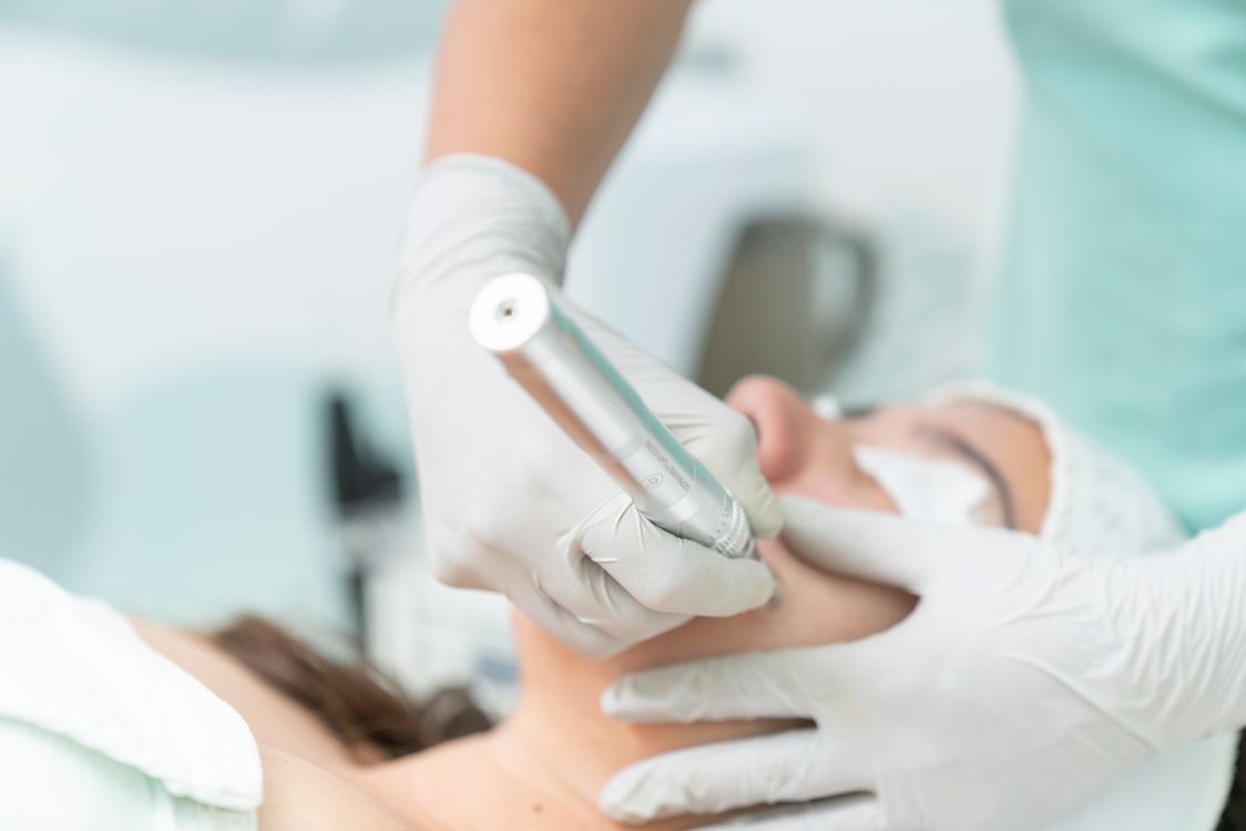 Procedimento estético facial sendo realizado em paciente
